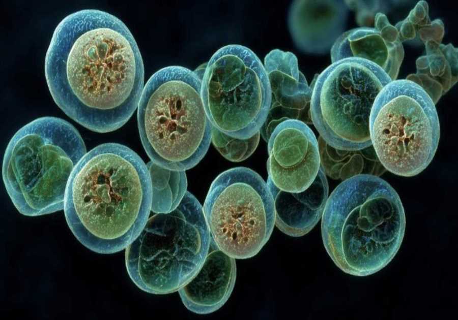 CDC, FDA say Cyclospora outbreak more widespread that originally thought
